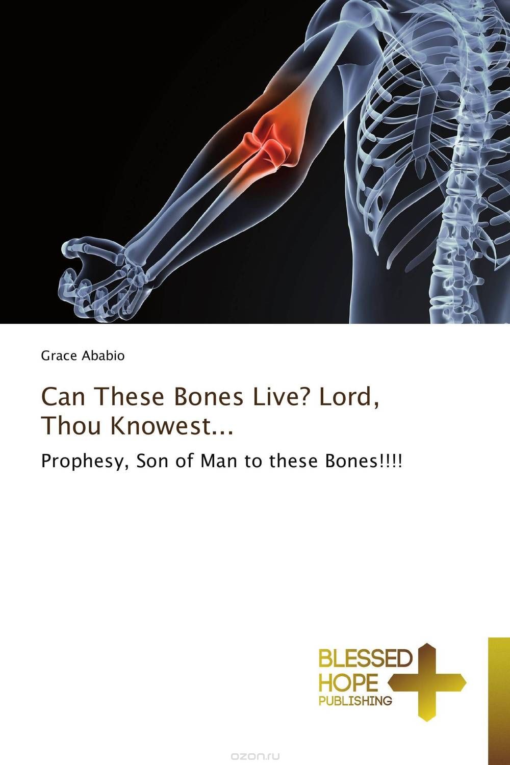 Скачать книгу "Can These Bones Live? Lord, Thou Knowest..."
