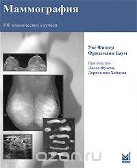 Скачать книгу "Маммография. 100 клинических случаев, Уве Фишер, Фридеманн Баум"