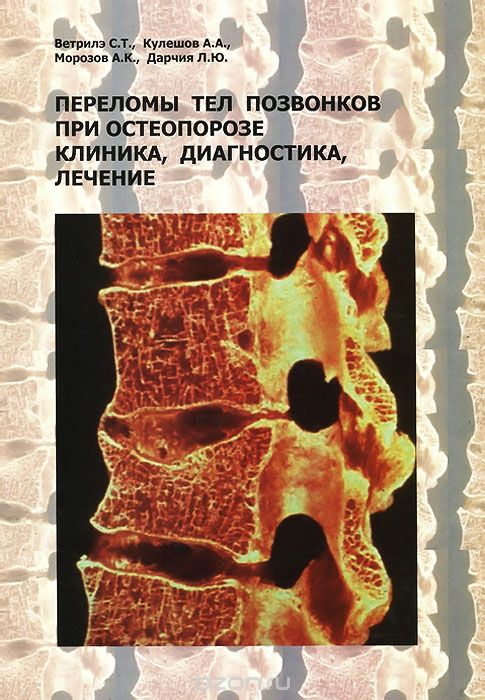 Скачать книгу "Переломы тел позвонков при остеопорозе. Клиника, диагностика, лечение, С. Т. Ветрилэ, А. А. Кулешов, А. К. Морозов, Л. Ю. Дарчия"