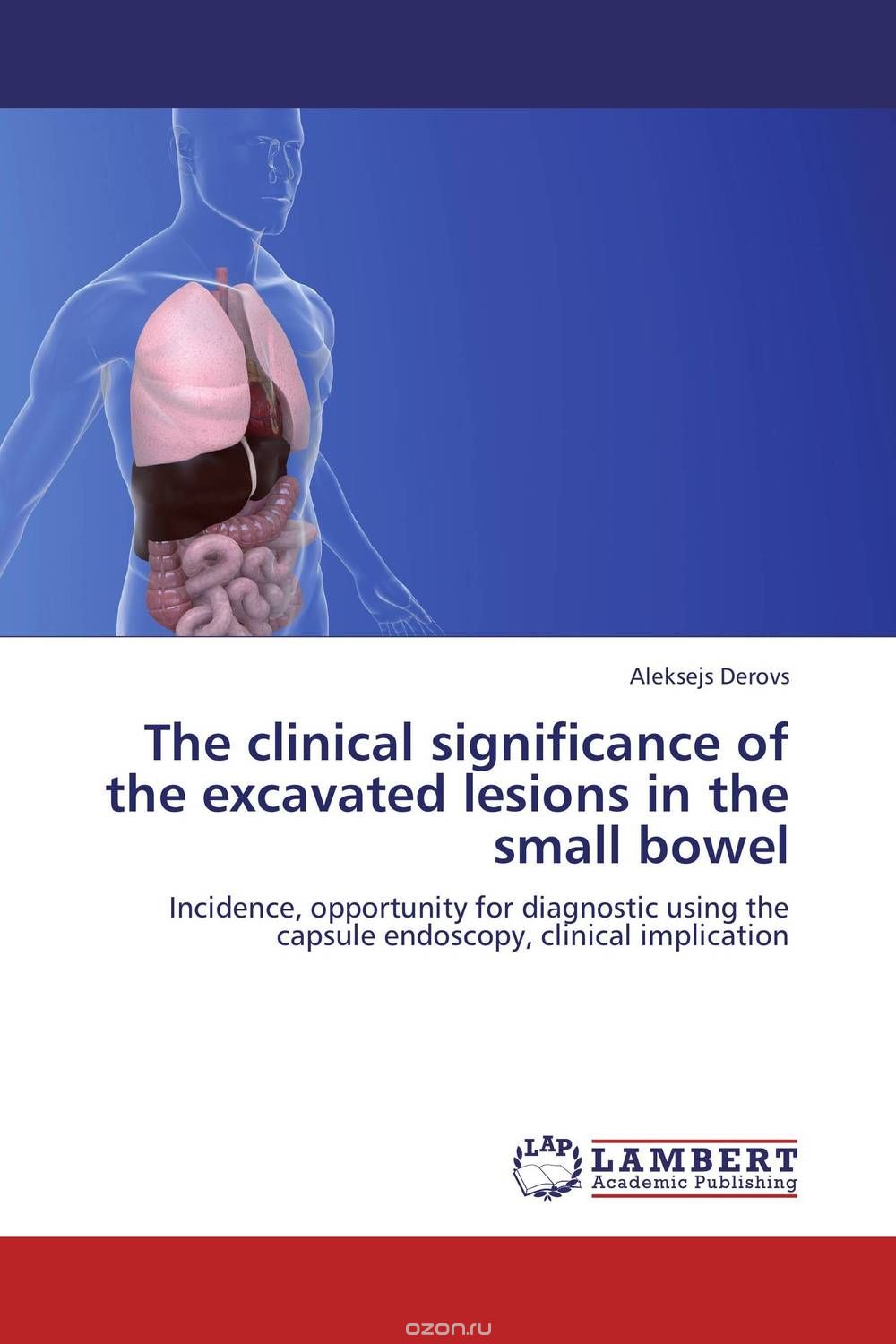 Скачать книгу "The clinical significance of the excavated lesions  in the small bowel"