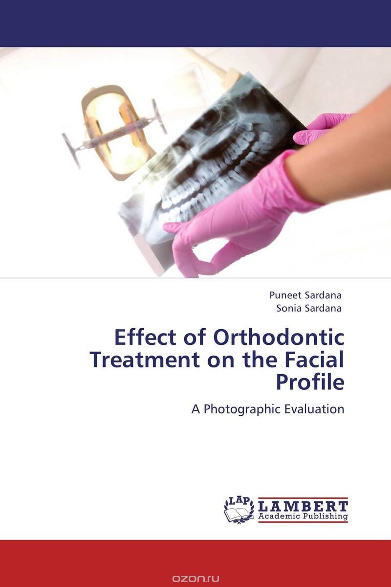 Скачать книгу "Effect of Orthodontic Treatment on the Facial Profile"