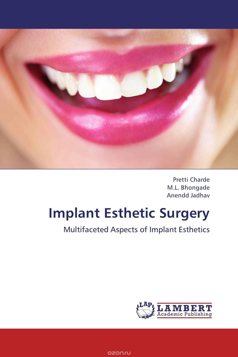 Скачать книгу "Implant Esthetic Surgery"